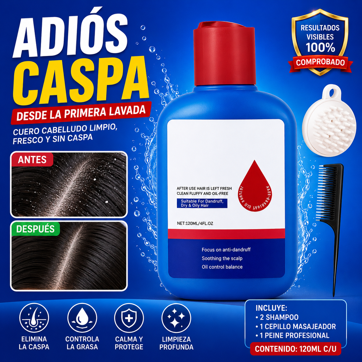 Shampoo Anticaspa – Limpieza Profunda y Control del Cuero Cabelludo