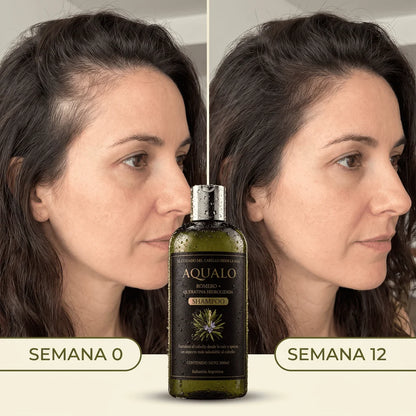 AQUALO™ Shampoo Anticaída y Crecimiento
